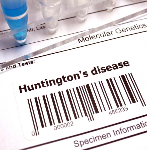 Huntington's disease