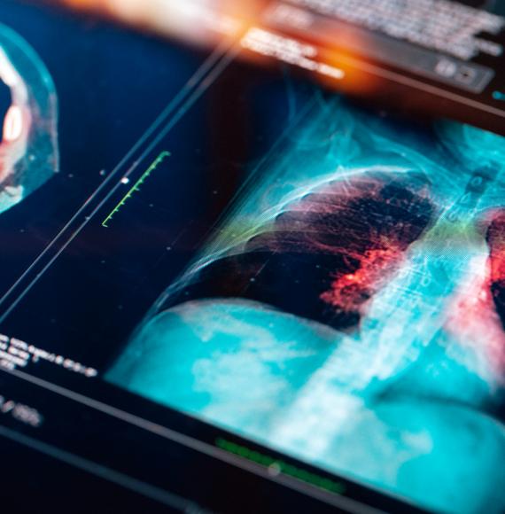 Lung cancer diagnostics