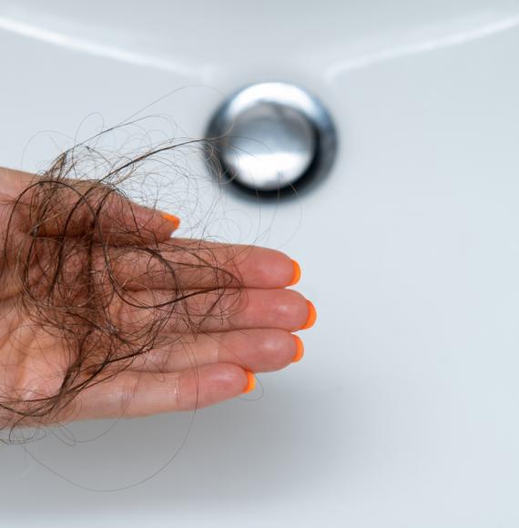 Hair loss from alopecia