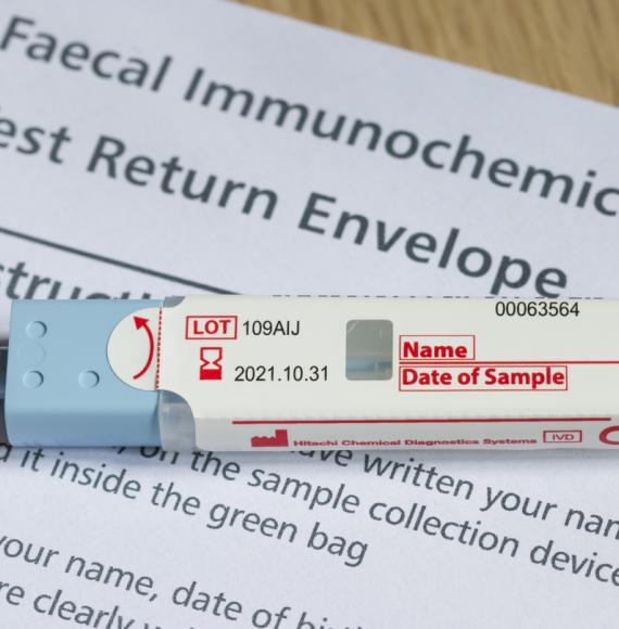 Bowel cancer screening