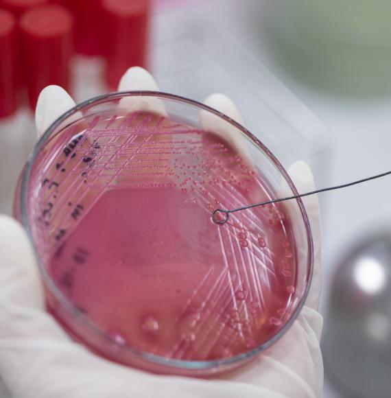 Antimicrobial resistance