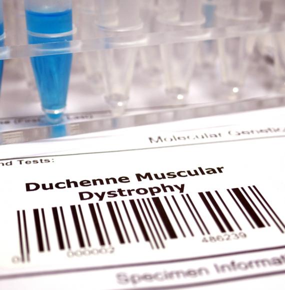 Duchenne muscular dystrophy genetic test