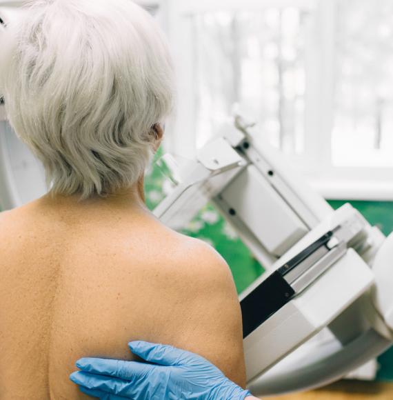 woman having a mammography scan