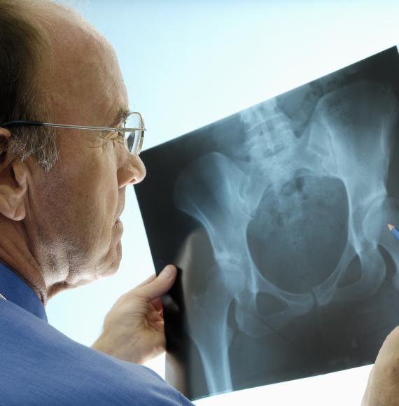 X-ray of someone's bones