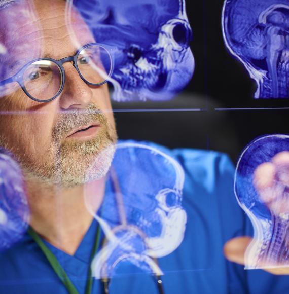 Medical professional looking at brain scans