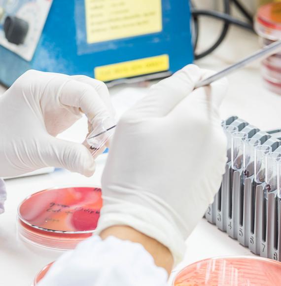 Bacteria culture