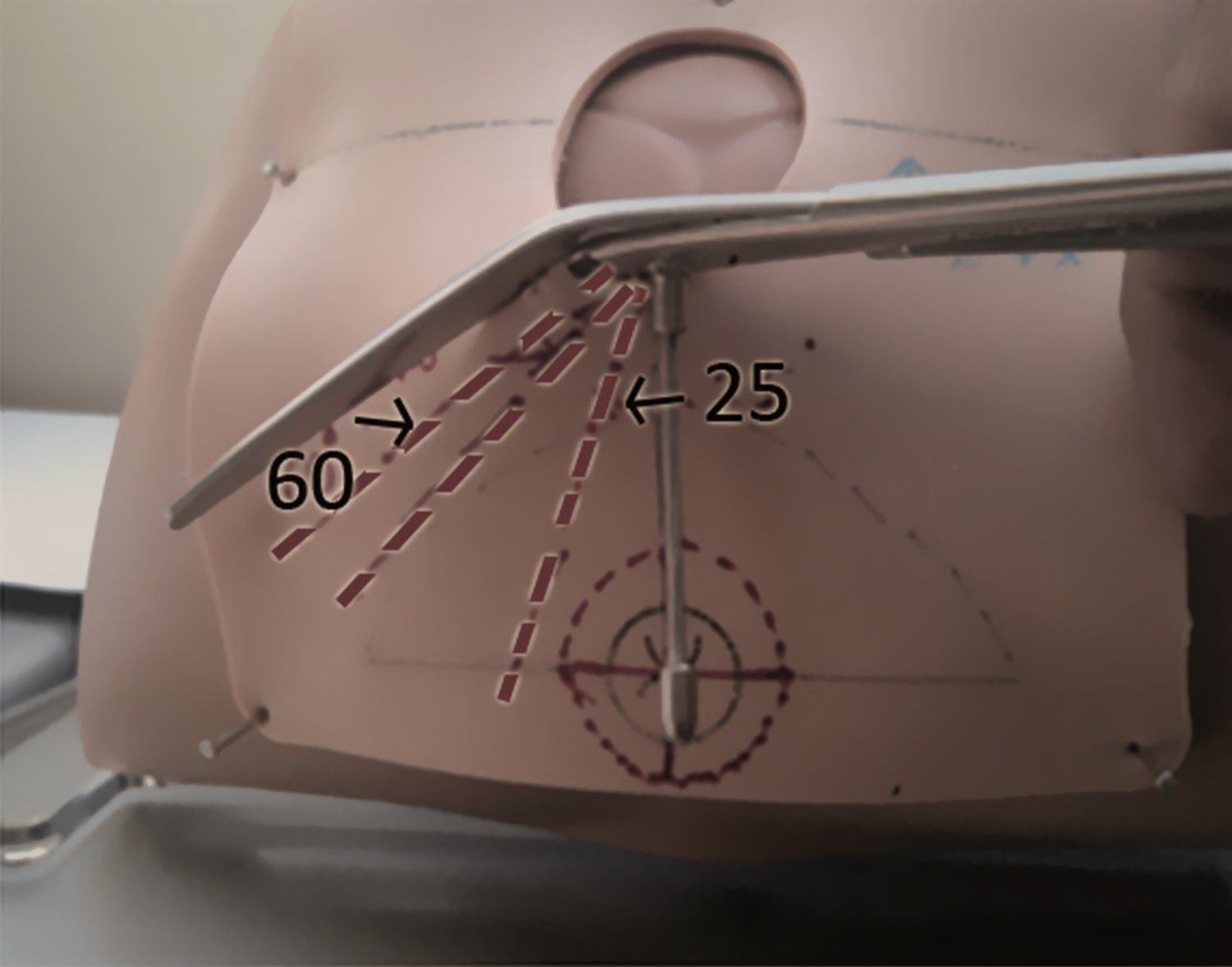 episcissors on modelToby1 episcissors on modelToby1